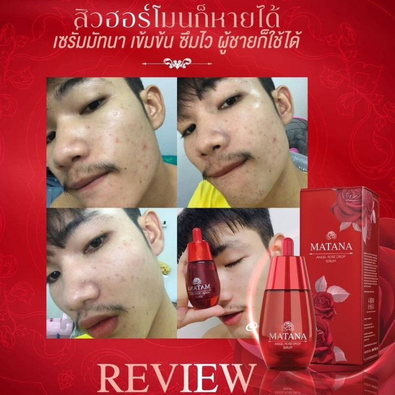 Rose Serum Bright Anti Aging Serum Rose Matana Angle Red bottle box 30 ml. x 1 gallery