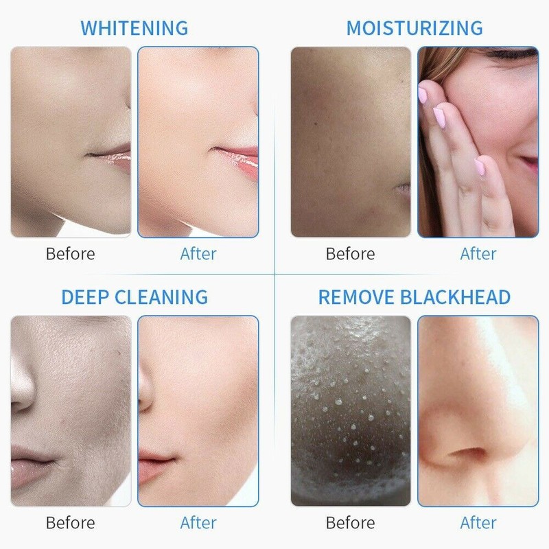 6 in 1 Hydro Dermabrasion Skin Deep Cleansing Facial Spa Bubble Beauty Machine gallery