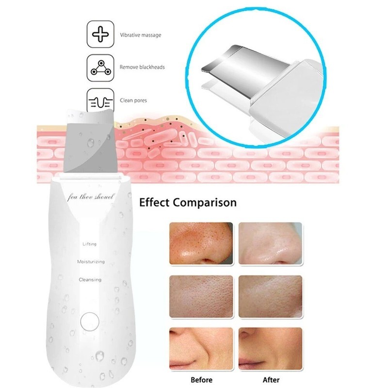 USB Rechargeable Skin Scrubber, Deep Clean, Blackhead Removal, Portable Beauty gallery