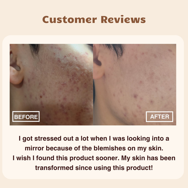 GD11 Premium Exosome Ampoule Set, Korean Stem Cell Serum for Glass Skin Glow gallery