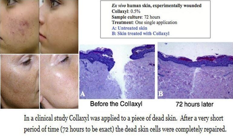 COLLAXYL® PEPTIDE COLLAGEN BOOSTER ACTIVE HEXAPEPTIDE-9 gallery