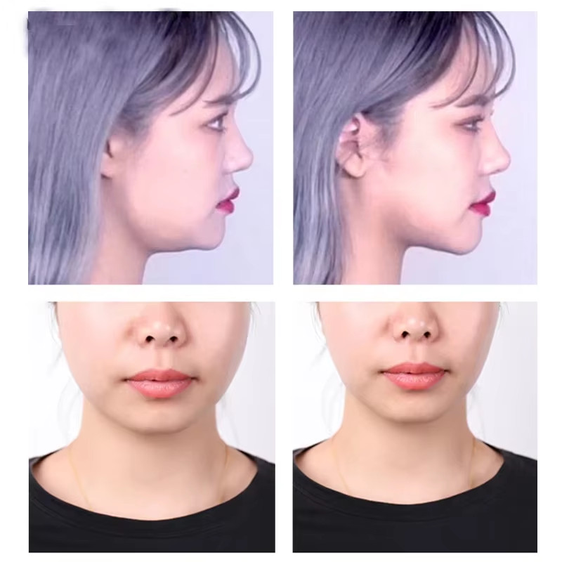 40-120PCS V-Shape Face Wrinkle Sagging Skin Adhesive Tape Lifting Face Stickers gallery