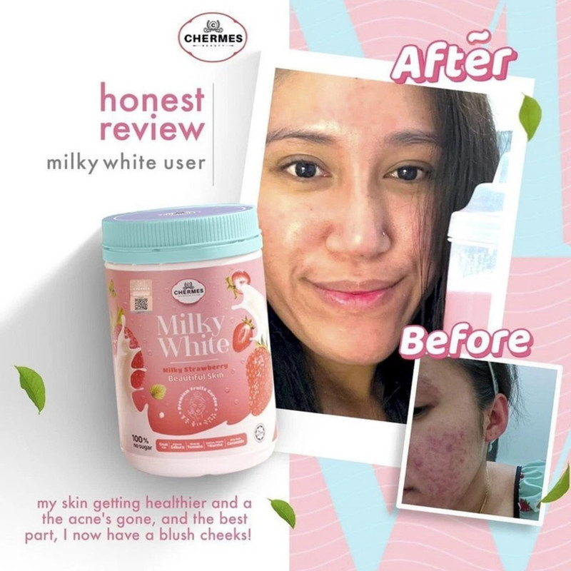 x4 K-Colly Chermes MilkyWhite Collagen 500g Strawberry Whitening Skin Supplement gallery