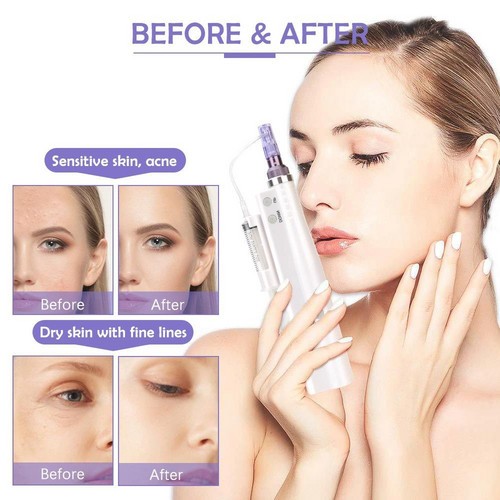 Portable Electric Beauty Machine For Anti-Aging And Wrinkle Reducing Beauty Pen gallery
