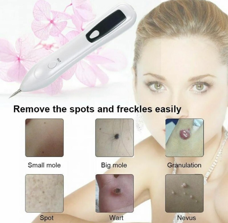 Portable Spot Remover Pen Usb Rechargeable MY-036 Skin - New Open Box gallery