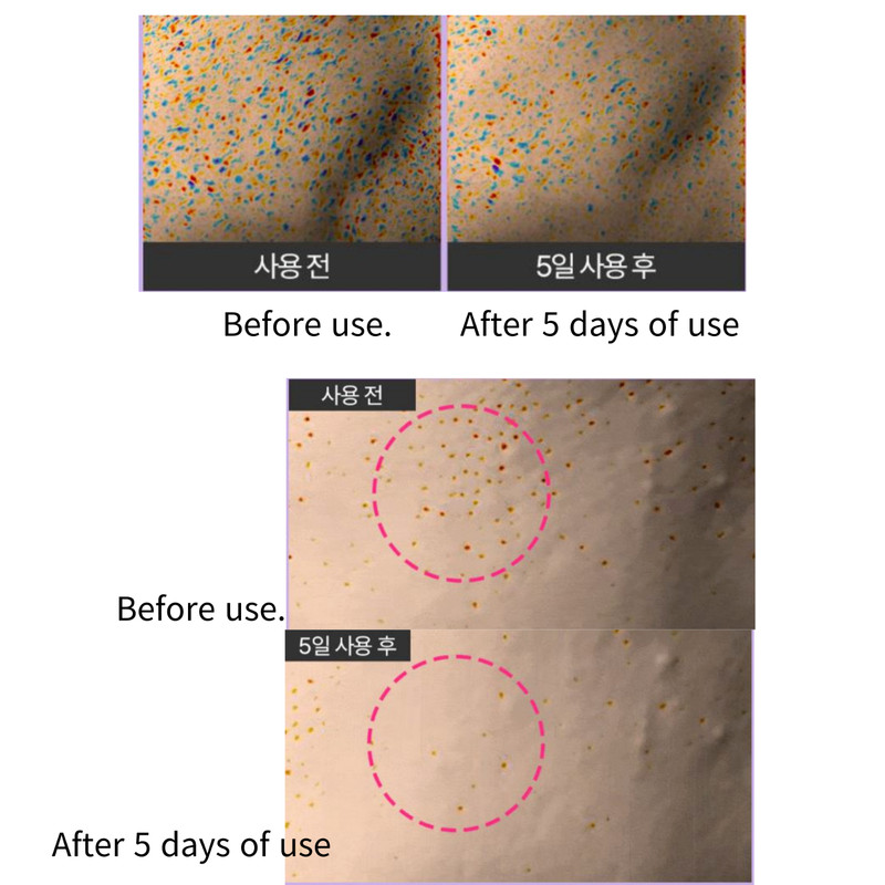 Rootree Mulberry 5D Pore Refining Ampoule Pore Care Elasticity Enhancing 50ml gallery