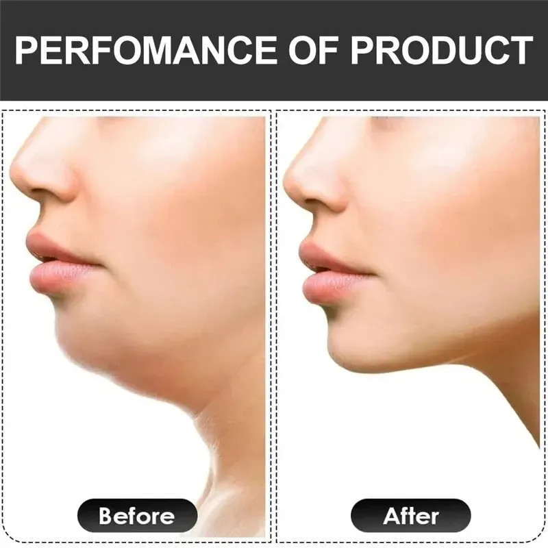 U Shape Jaw Exerciser New Facial Mouth Jawline Face Fitness Muscle Chew Ball Bit gallery
