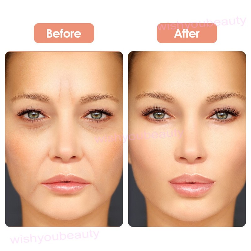 16 PCS Anti Wrinkle Neck Eye Face Pad Silicone Removal Patch Skin Lift Overnight gallery