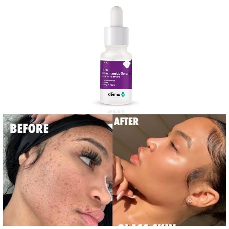 The Derma Co 10% Niacinamide Face Serum 10ml For Acne Marks & Acne Prone Skin