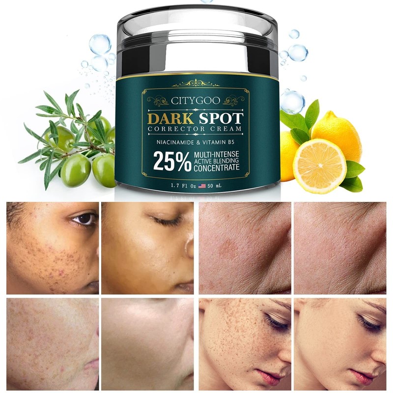 Dark Spot Remover for Face: Dark Spot Corrector Cream – Enriching Skin Care F…