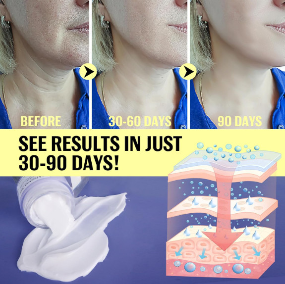2024 New Pure Neck Firming Cream, Anti-Aging Tighten & Lift Neck Cream, Chest Ne gallery