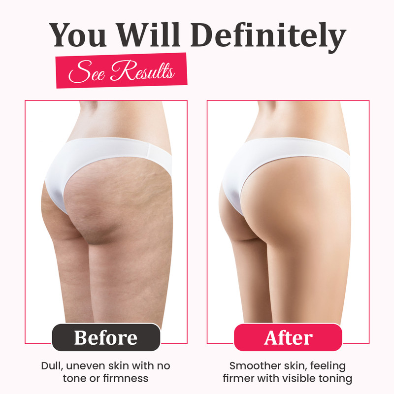 Sexy Legs Kit - Anti Cellulite Massage Oil, Firming Cream & Body Scrubber BUNDLE gallery