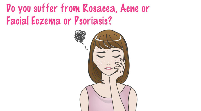 Rosacea Cream, for red face rosacea and removes fine lines gallery