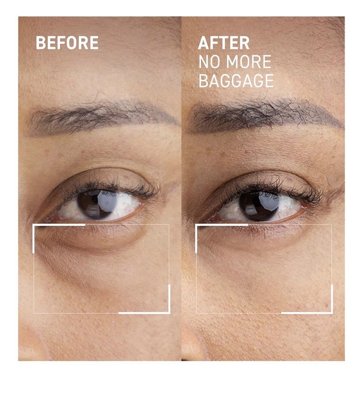Dr. Brandt Needles No More, No More Baggage - Minimizes Under-Eye Bags gallery