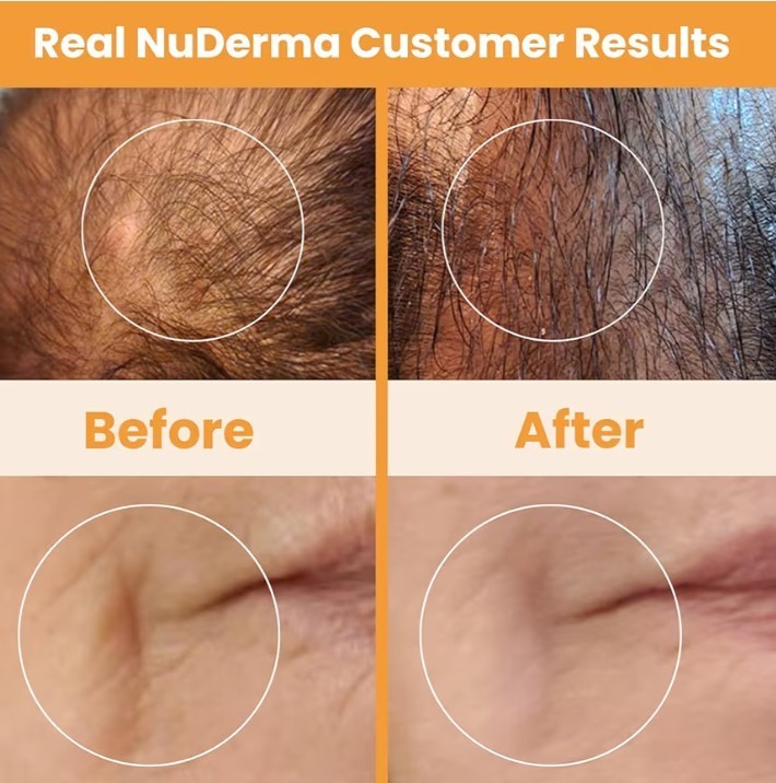 Pure Daily Care NuDerma Portable Handheld Skin Therapy Wand Machine -... gallery