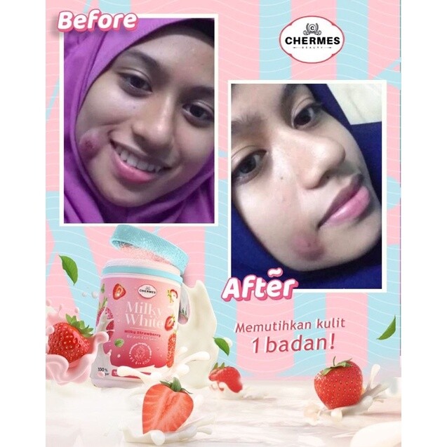 Chermes Milky White Strawberry Powder Whitening Skin Supplement by KColly gallery