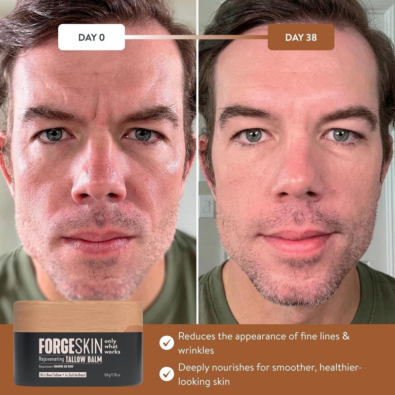 Forge Skin® Wrinkle Defense Beef Tallow Balm for Men TALLOWBASED Moisturizer ... gallery