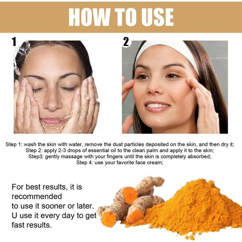 Turmeric Freckle Whitening Serum Curcumin Oil Face Brighten Fade Dark Spot Remov gallery