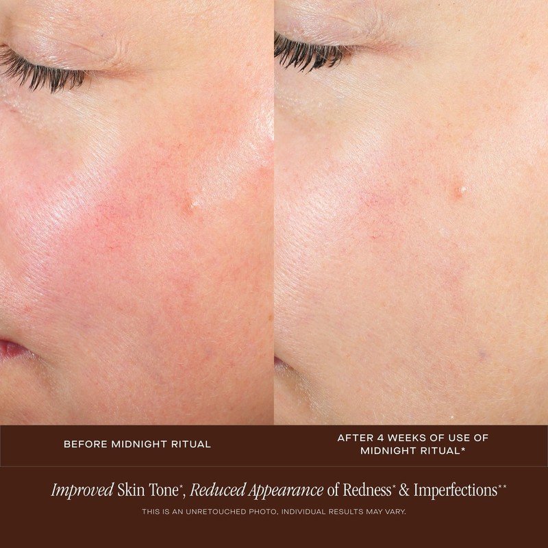 Summer Fridays Midnight Ritual Retinol Serum - Renewal Anti Aging Serum for F... gallery