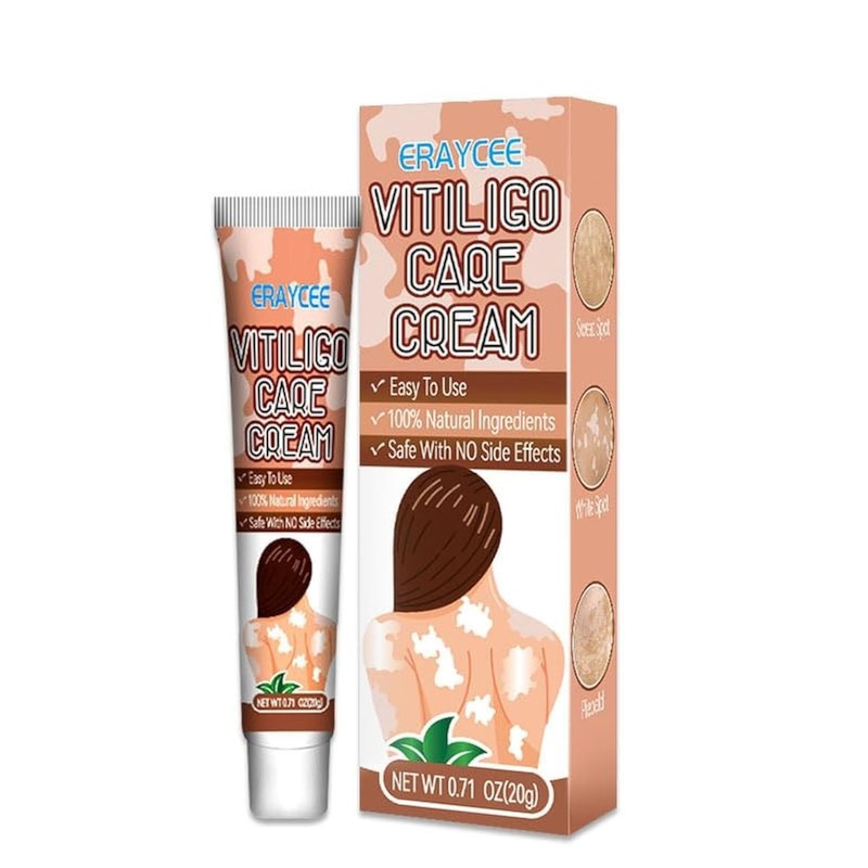 Gentle Vitiligo Cream for All Skin Types – Natural Treatment with Ginkgo Biloba