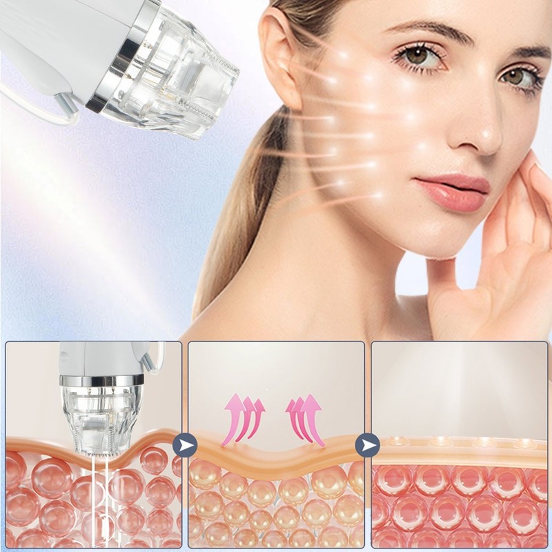 2in1 RF Micro-n-eedle Machine Cold Hammer Scars Spot Removal Skin Beauty Device gallery