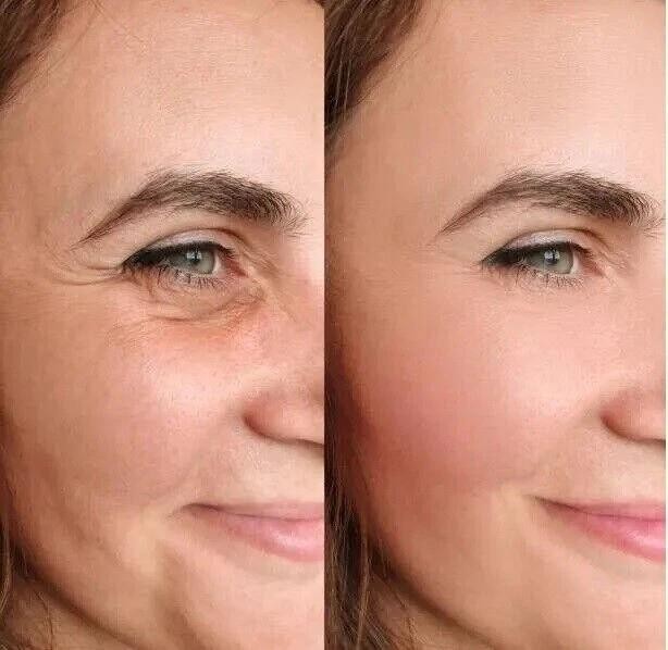 Under Eye Cream Gel for Dark Circles, Puffy Eyes, Wrinkles Remove for UNISEX 20g gallery