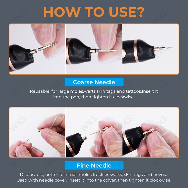Skin Tag Remover - Skin Tag and Mole Remover for Home Use, Portable Removal Kit gallery