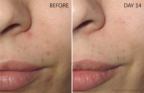 Niacinamide Vitamin B3 Serum Cream with Hyaluronic Acid Anti Aging Wrinkle Acne gallery