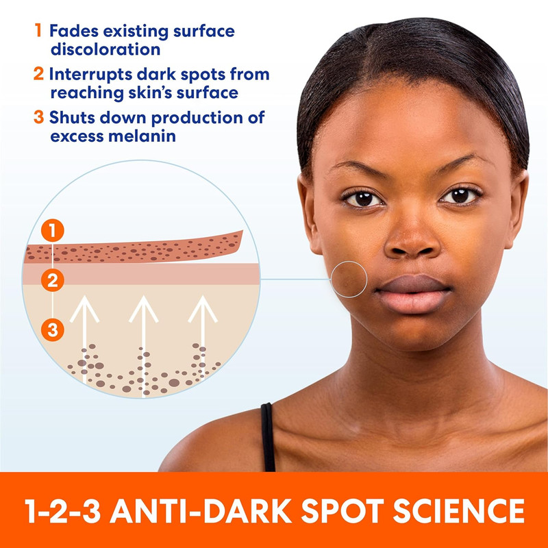 Skin Success Anti-Dark Spot Fade Cream with Vitamin E and Niacinamide, for All S gallery