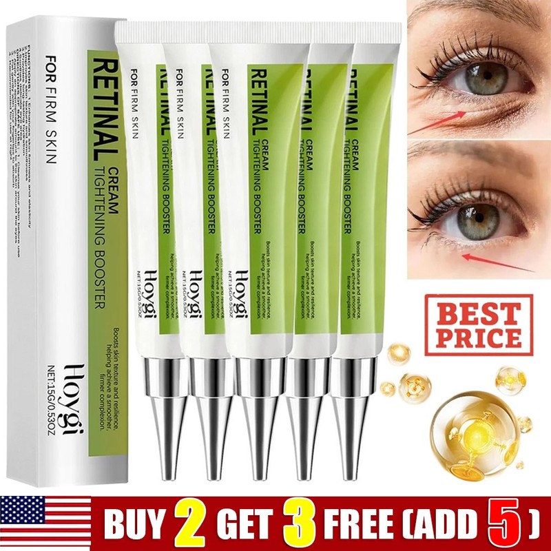 Retinol Eye Cream, Eye Bags Removal To Fight Fine Lines, Wrinkles & Dark Spots