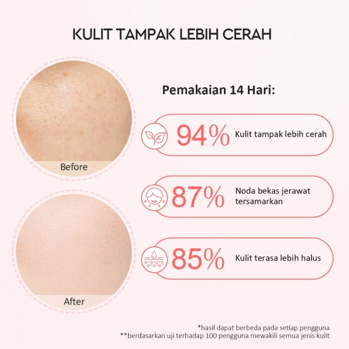 GLAD2GLOW 10% Niacinamide Brightening Serum Acne Scars Dark Spot Anti-Aging 17ml gallery
