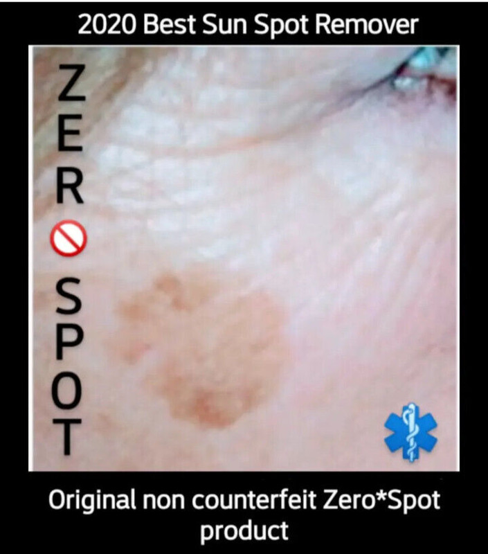 Sun Spot, Age Spot, Brown Spot, Dark Spot Corrector Treatment Remover: No Scam💙