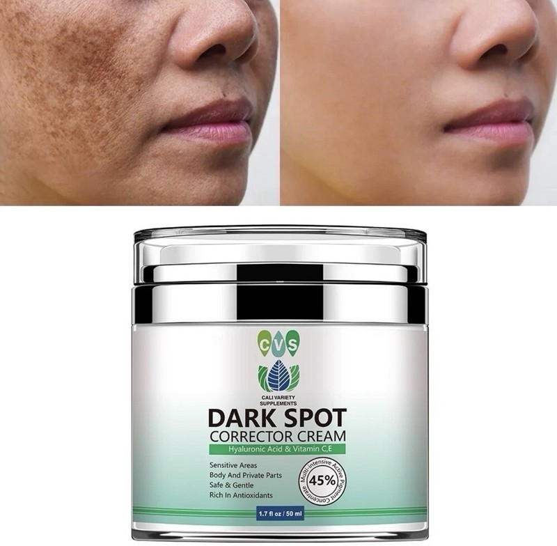 Dark Spot Corrector Face Neck Skin Dark Spot Remover Cream 45% Active Pigment gallery