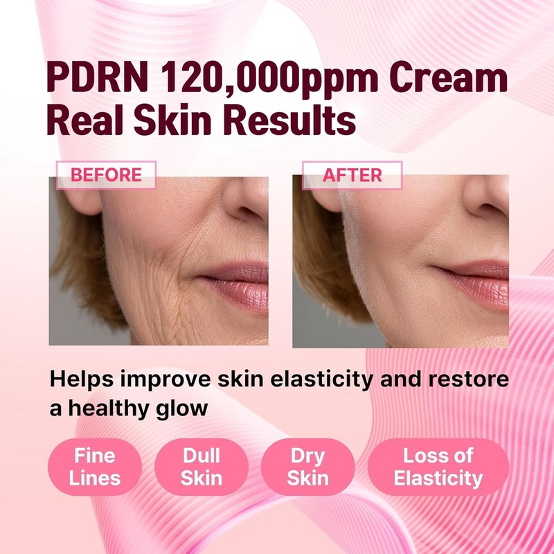 PDRN 120,000 ppm EGF Peptide Cream Volufiline Salmon DNA + 12% Phyto PDRN 1.7 oz gallery