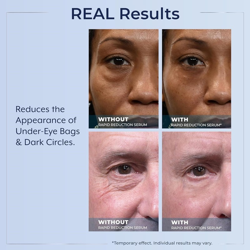 Plexaderm Rapid Reduction Serum - Visibly Reduces Under-Eye Bags & Wrinkles 2026 gallery