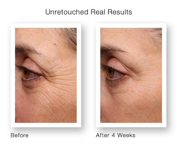 RETINOL VITAMIN A 5% + HYALURONIC ACID + Vitamin E - WRINKLE SERUM / CREAM gallery