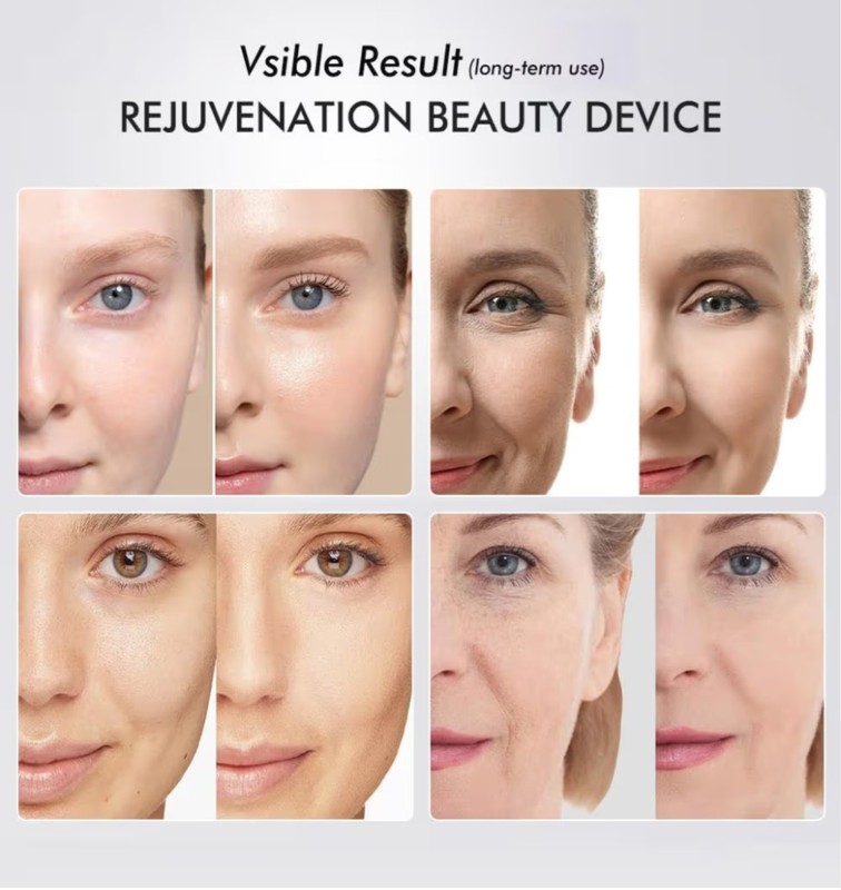 6-in-1 LED & Microcurrent Skin Rejuvenation Beauty Device | New & Sealed gallery