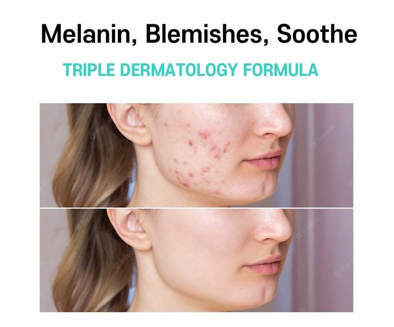 Korean Skin Care Cream with Centella Asiatica - Dark Spot & Brightening Solution gallery