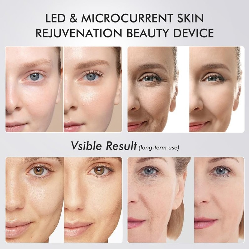 1Pcs Latest Bestseller Handheld | 6-in-1 Glow Device Whitening Beauty Device gallery