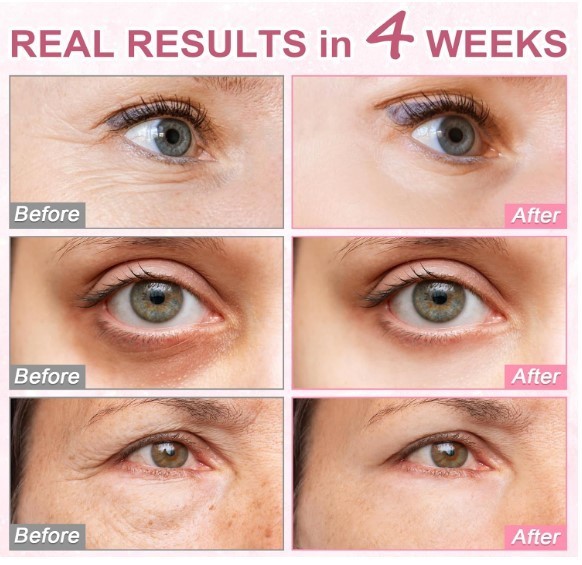 5% Caffeine Eye Serum with Hyaluronic Acid & Niacinamide gallery