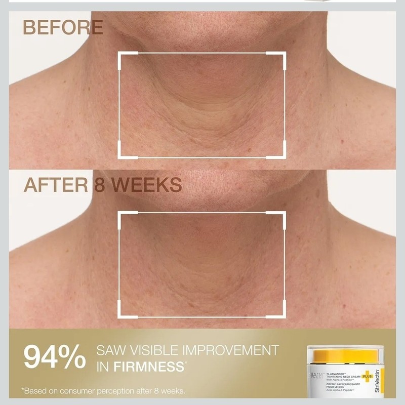 StriVectin Tighten & Smooth Neck Cream and Neck Serum Roller Anti-aging Skin Car gallery