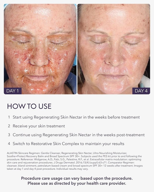 ALASTIN Skincare Crema hidratante facial de néctar regenerante para la piel (1 o gallery