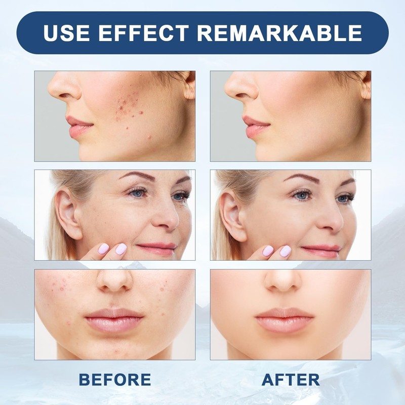 3 Pcs Liquid Facial Serum – Anti-Aging, Boost Collagen, Smooth Lines & Wrinkles. gallery