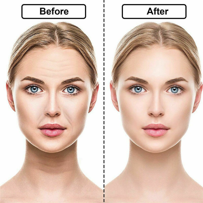 16Pack Soft Anti Wrinkle Silicone Sticker Face Forehead Neck Eye Pad Patches t gallery