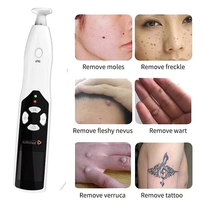Ozone Plasma Pen 2-in-1 Portable Eyelid Lift Dark Spot Wart Remover gallery