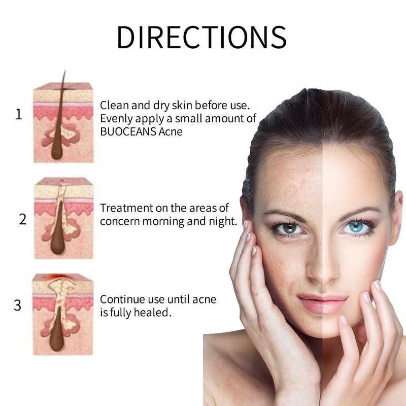 Dark Spot Corrector Face Neck Skin Dark Spot Remover Cream 45% Active Pigment gallery