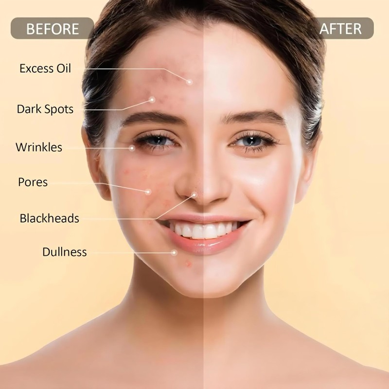 Vitamin C Peel Off Face Mask, Turmeric Moisturizing Mask, Deep Cleansing Face... gallery