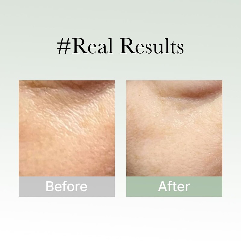 Arencia - Holy Hyssop Serum 30 - Overnight Face Mask. Hydrating & Anti-Aging gallery