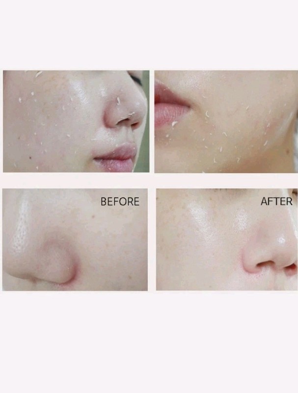 *NEW* 2 Pack SNAIL PEELING GEL SKIN SOFT PEELING GEL 180ml - KOREAN PRODUCT gallery
