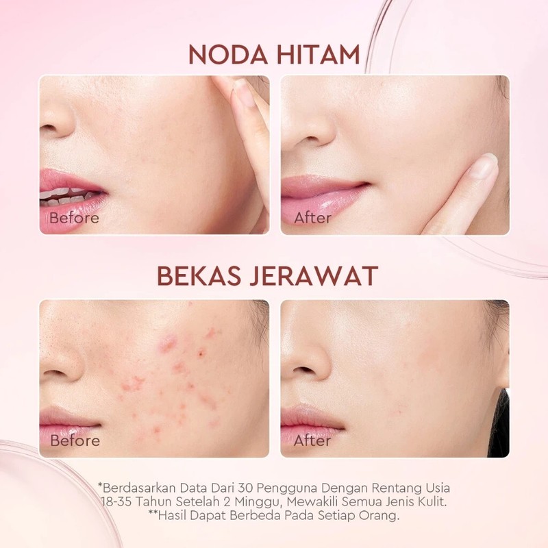 GLAD2GLOW 10% Niacinamide Brightening Serum Acne Scars Dark Spot Anti-Aging 17ml gallery